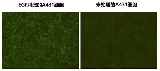 使用THE? 磷酸化抗體 (E10)plus進行免疫熒光分析