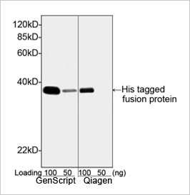 His tag Antibody