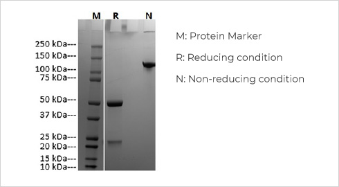 SDS-PAGE analysis 