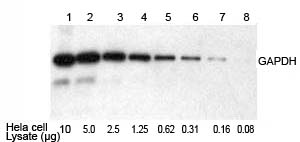 Western blot kit